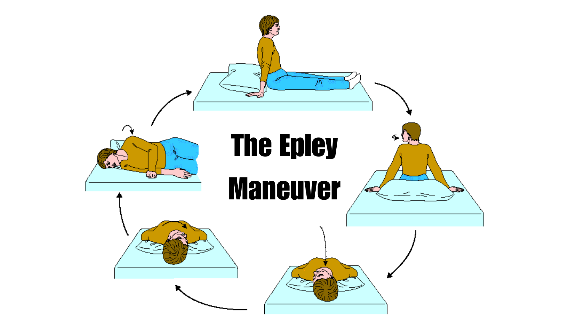 The Epley Maneuver